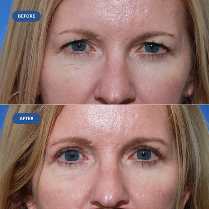 EyeLift Re-Tone Cream